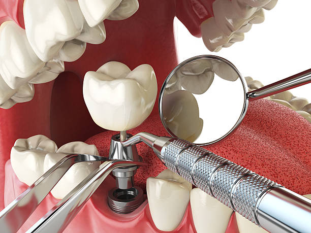 Best Emergency Tooth Extraction in West Berlin, NJ
